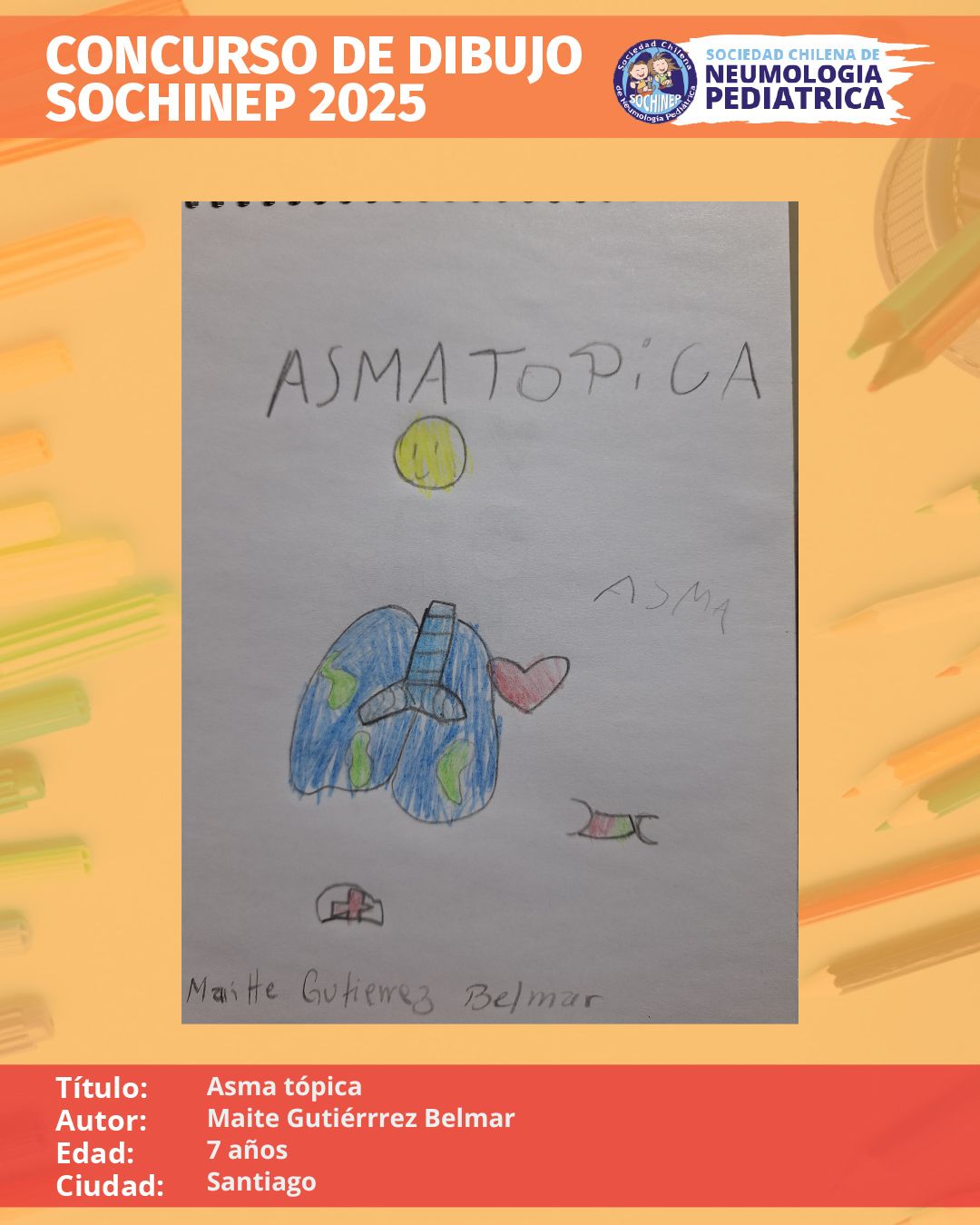 Asma tópica